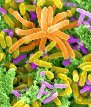Electron microscopy image of microbes in Lake Washington sediment