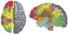 Color diagram of a cat brain