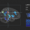 Visualization of the human brain