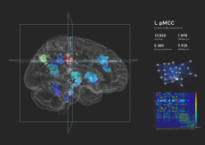 Visualization of the human brain