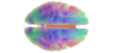 Colorful visualization of the human brain