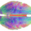 Colorful visualization of the human brain