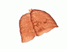 Lung Screening 3D moving gif image