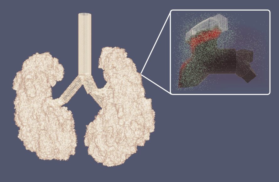 A key question in SARS-CoV-2 infection is why viral loads and patient outcomes are so different across individuals. Because it’s difficult to see how the virus spreads in the lungs of infected people, researchers developed SIMCoV, a computational model that simulates hundreds of millions of cells, including lung cells and immune cells. (Credit: Steve Hofmeyr/Berkeley Lab)